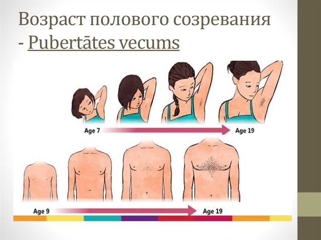 Картина переходный возраст