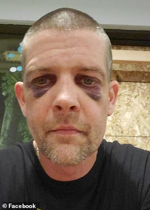 Adam Haner was knocked unconscious during the attack on Sunday evening. He was also left with two black eyes